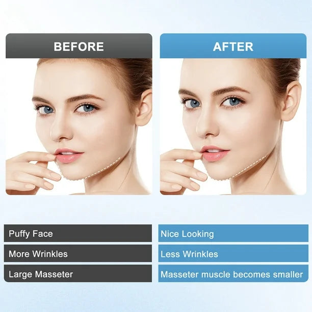 Facial Slimming Device Cosmetic Slimming Device